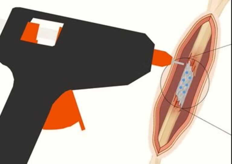 A Modified Hot Glue Gun Shows Promise Of Mending Broken Bones With 3D Printing Process